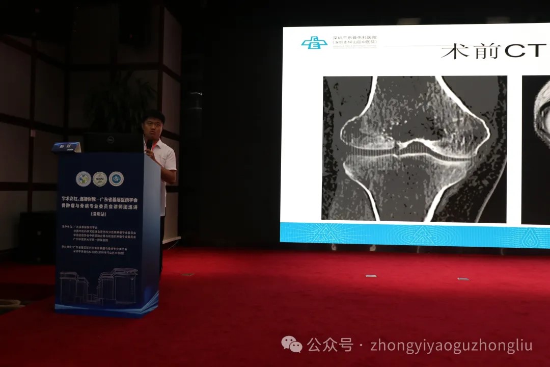 深圳平乐骨伤科医院陈强教授作病例汇报